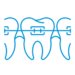 Braces Treatment